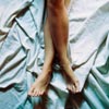 Beine Cellulitis Beine Cellulitis